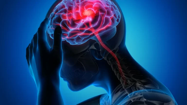 Cegah Stroke